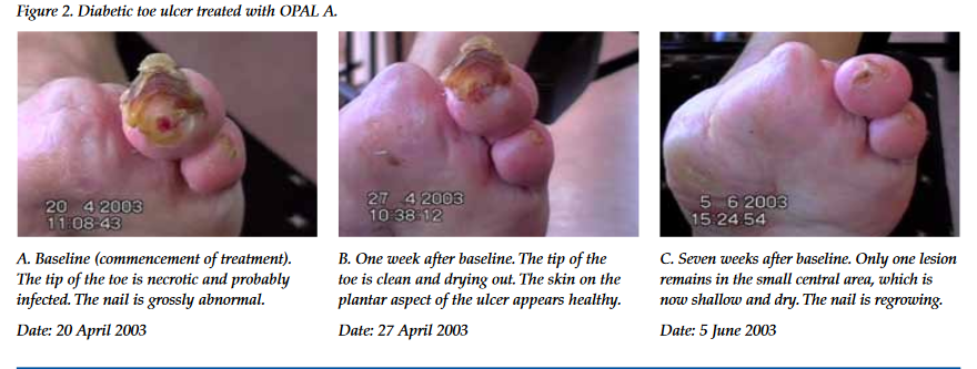 Opal PNG HD Image pngteam.com